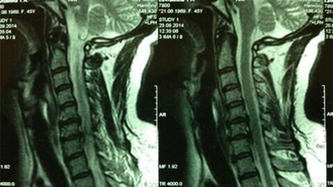 MRI Раёсати гардиш